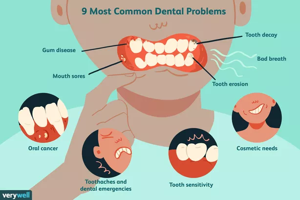 top-common-dental-problems
